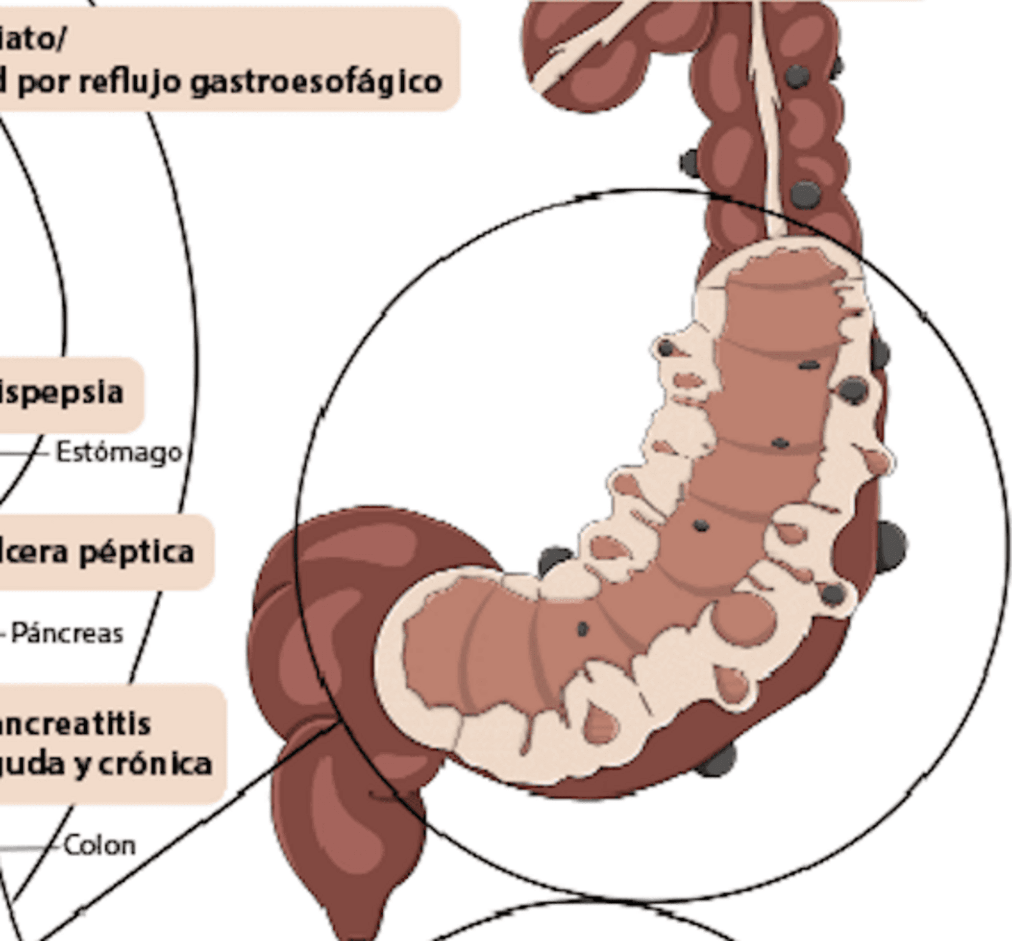 Lámina enfermedades del aparato digestivo - 3